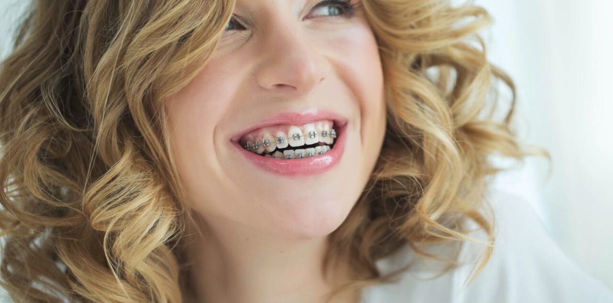 adult braces patient in long beach ca